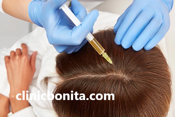 ترکیبات مزوتراپی مو | کلینیک بنیتا