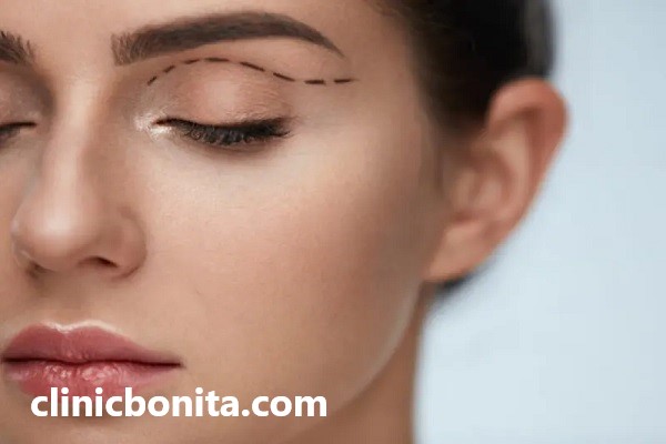 نکات مهم بعد از عمل بلفاروپلاستی | کلینیک بنیتای اصفهان