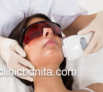 درمان لک های پوست با روش لیزر کیوسوئیچ در اصفهان | کلینیک بنیتای اصفهان