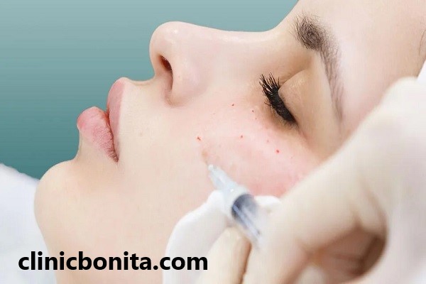 بهترین متخصص جوانسازی و مزوتراپی پوست در اصفهان | کلینیک بنیتای اصفهان