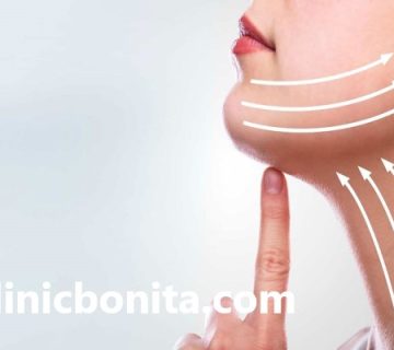 بهترین کلینیک لیفت غبغب با نخ در اصفهان | کلینیک بنیتا