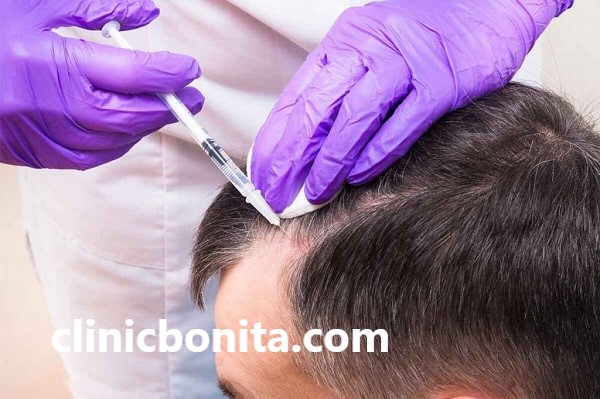 مواد تشکیل دهنده فیلر مو | کلینیک بنیتا اصفهان