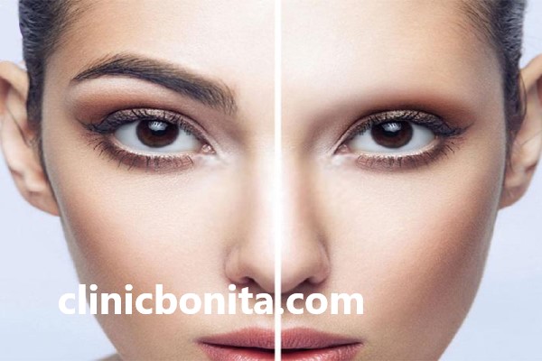 بهترین کلینیک کاشت ابرو در اصفهان | کلینیک بنیتا