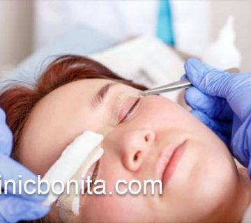 بهترین کلینیک تخصصی بلفاروپلاستی در اصفهان | کلینیک بنیتای اصفهان