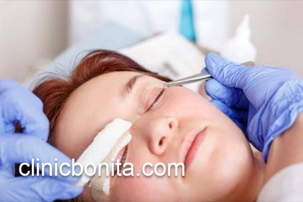 بهترین کلینیک تخصصی بلفاروپلاستی در اصفهان | کلینیک بنیتای اصفهان