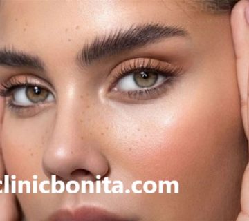 بهترین کلینیک لیفت شقیقه با نخ در اصفهان | کلینیک بنیتای اصفهان