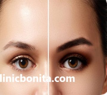 بهترین کلینیک کاشت ابرو در اصفهان | کلینیک بنیتا