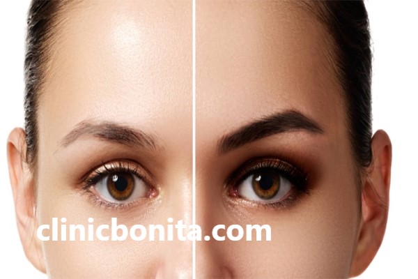 بهترین کلینیک کاشت ابرو در اصفهان | کلینیک بنیتا