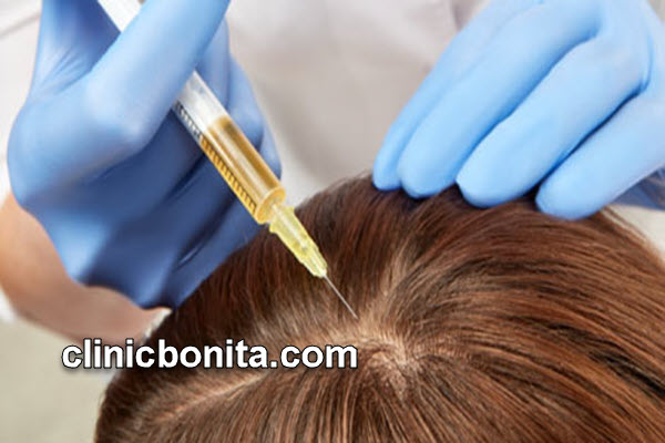 بهترین کلینیک پی آر پی مو (PRP) در اصفهان | کلینیک بنیتای اصفهان