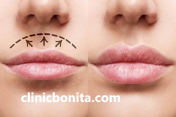 مراقبت های بعد از سانترال لب | کلینیک بنیتا اصفهان