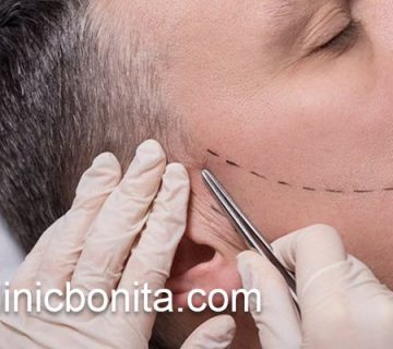 کاشت ریش با قیمت مناسب در اصفهان | کلینیک بنیتای اصفهان