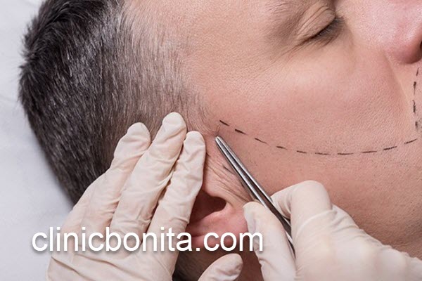 کاشت ریش با قیمت مناسب در اصفهان | کلینیک بنیتای اصفهان