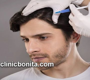 هزینه هر جلسه پی آر پی مو (PRP) چقدر است؟ | کلینیک بنیتای اصفهان