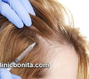 بهترین کلینیک پی آر پی مو (PRP) در اصفهان | کلینیک بنیتای اصفهان