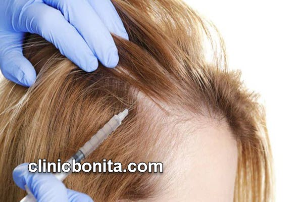 بهترین کلینیک پی آر پی مو (PRP) در اصفهان | کلینیک بنیتای اصفهان