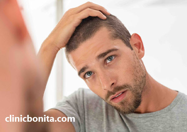 کاشت مو در اصفهان با بهترین قیمت - کلینیک بنیتا