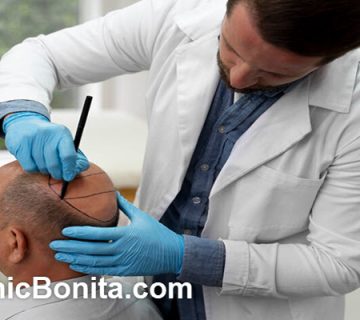 بهترین متخصص کاشت مو در اصفهان | کلینیک بنیتای اصفهان