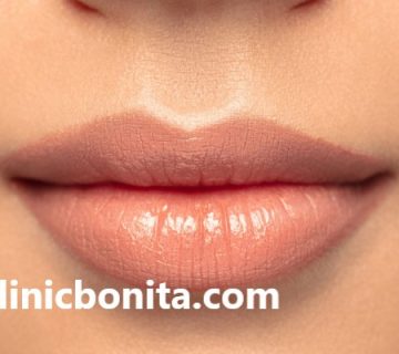 دکتر خوب برای لیفت سانترال لب در اصفهان | کلینیک بنیتا