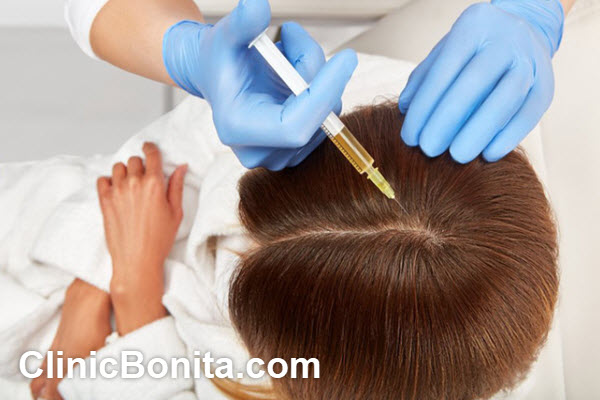 بهترین دکتر پی آر پی مو (PRP) در اصفهان | کلینیک بنیتای اصفهان