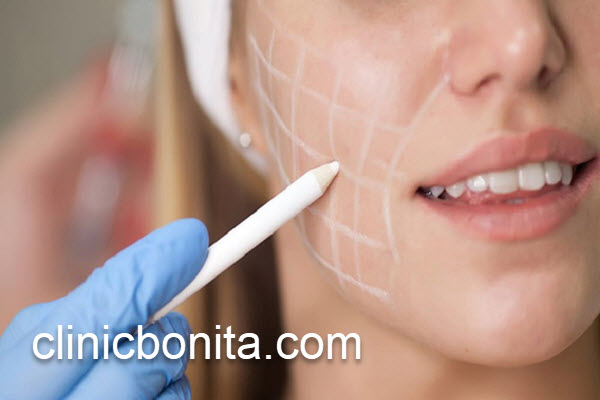 بهترین مرکز زیبایی جراحی بوکال فت | کلینیک بنیتای اصفهان