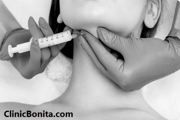 لیپوساکشن غبغب چیست؟