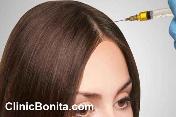 مراحل انجام پی آر پی مو شامل چه فرآیندی است؟ | کلینیک بنیتای اصفهان