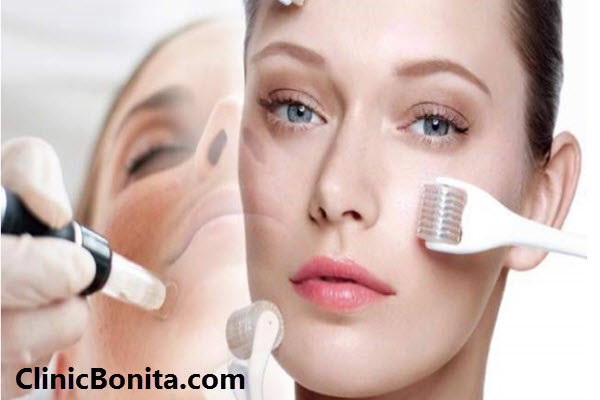 میکرونیدلینگ چگونه انجام می شود؟