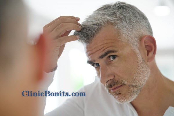 انواع کاشت مو | کلینک بنیتا اصفهان