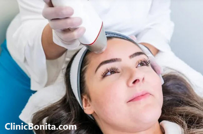 The price of fractional facial RF in Isfahan