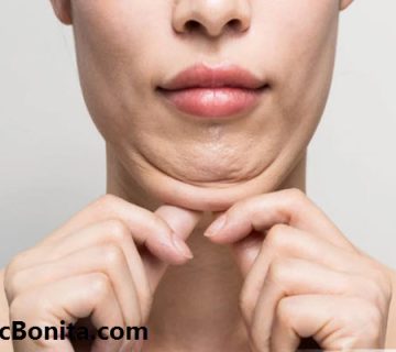 بهترین کلینیک ساکشن غبغب در اصفهان