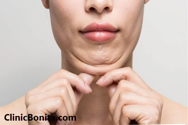 بهترین کلینیک ساکشن غبغب در اصفهان