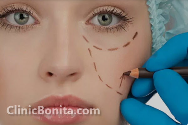 عمل بلفاروپلاستی چیست؟