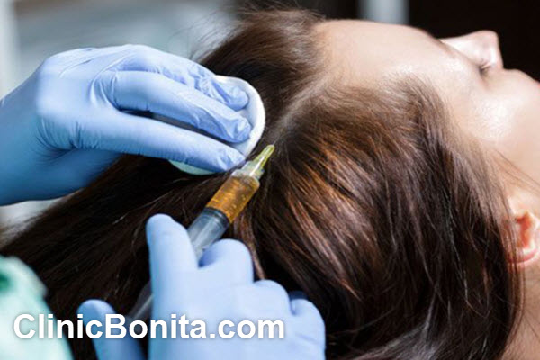 پی آر پی مو چیست؟ | کلینیک بنیتای اصفهان