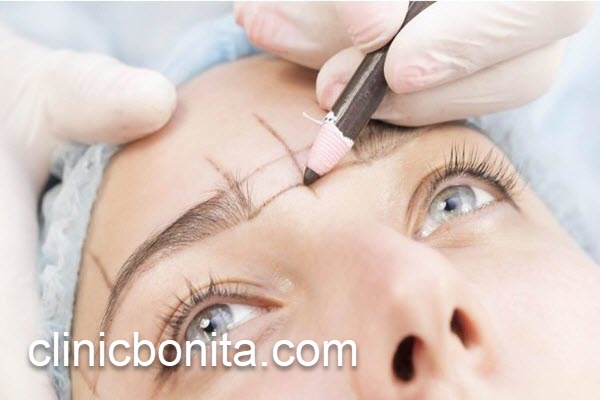 کاشت ابرو با بهترین روش در اصفهان | کلینیک بنیتای اصفهان