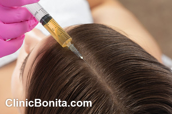 پی آر پی مو چه مزایایی دارد؟ | کلینیک بنیتای اصفهان