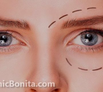 بهترین کلینیک برای عمل بلفاروپلاستی در اصفهان