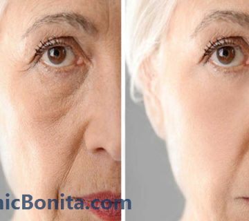 بهترین کلینیک لیزر co۲ فرکشنال در اصفهان