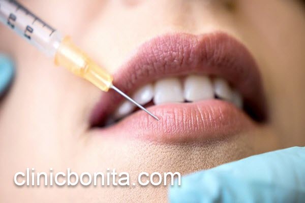 بهترین پزشک متخصص تزریق ژل لب | کلینیک بنیتای اصفهان