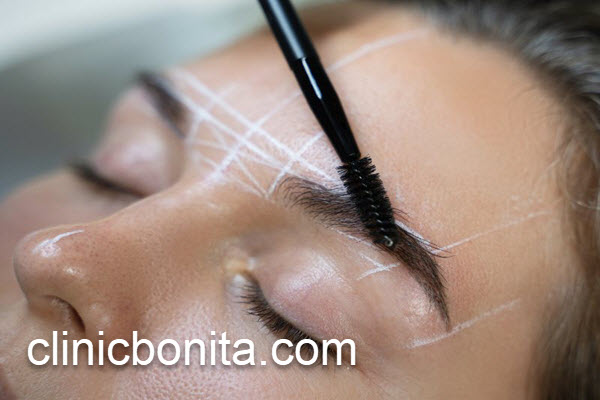 بهترین کلینیک لیفت ابرو در اصفهان | کلینیک بنیتای اصفهان