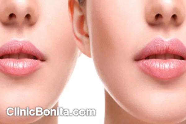 عمل سانترال لب چیست؟ | کلینیک بنیتای اصفهان