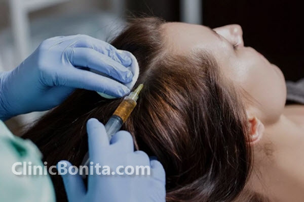 ویژگی های پی آر پی مو | استان اصفهان