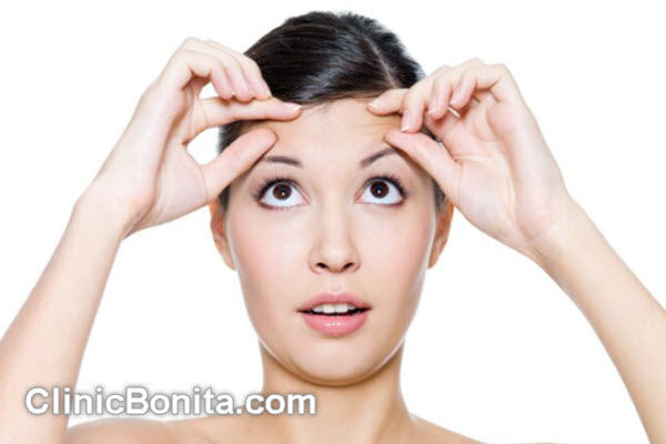 ماندگاری لیفت شقیقه چقدر است؟ | کلینیک بنیتای اصفهان