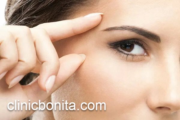 ماندگاری لیفت شقیقه با نخ چقدر است؟ | کلینیک بنیتای اصفهان