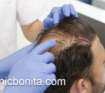 کاشت مو با بهترین تکنیک در اصفهان | کلینیک بنیتای اصفهان