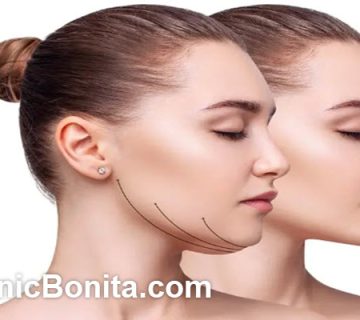 هزینه ساکشن غبغب در اصفهان | کلینیک بنیتا