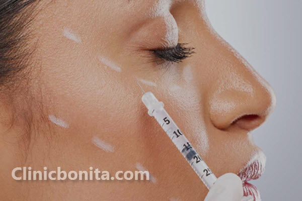 فواید تزریق چربی به صورت