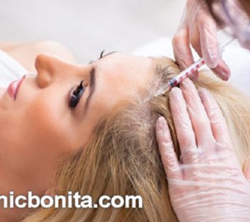 تعداد جلسات پی آر پی مو | کلینیک بنیتای اصفهان