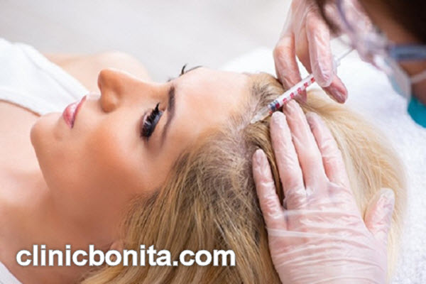 تعداد جلسات پی آر پی مو | کلینیک بنیتای اصفهان