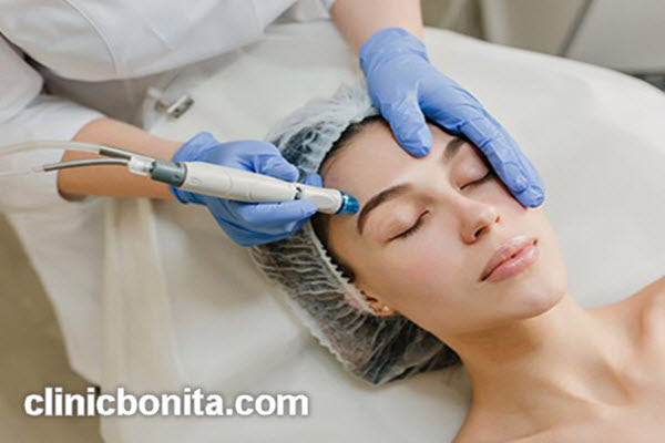 هزینه مزوتراپی صورت در اصفهان | کلینیک بنیتای اصفهان