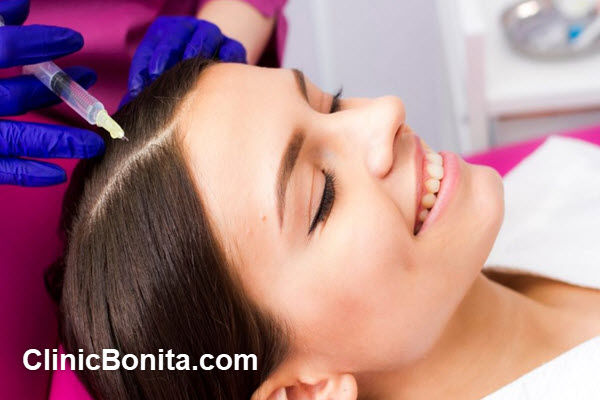 تزریق هیر فیلر مو | کلینیک بنیتای اصفهان